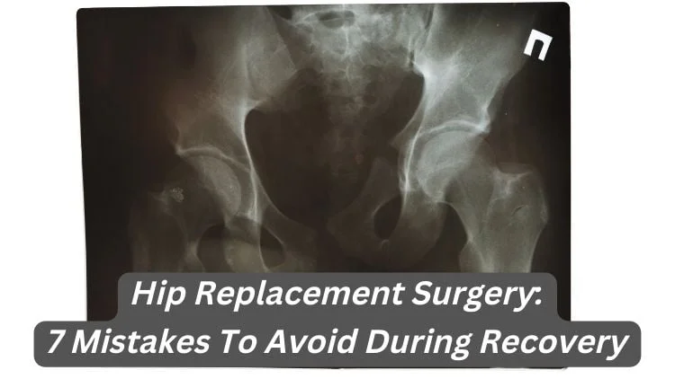 Hip Replacement Surgery: 7 Mistakes to Avoid During Recovery